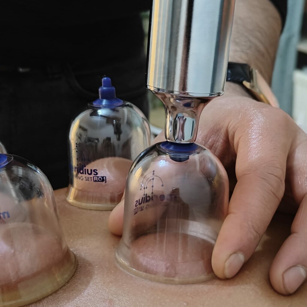cupping action